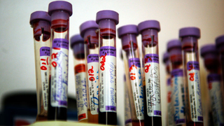 New HIV Cases Hit All-Time Low in New York City
